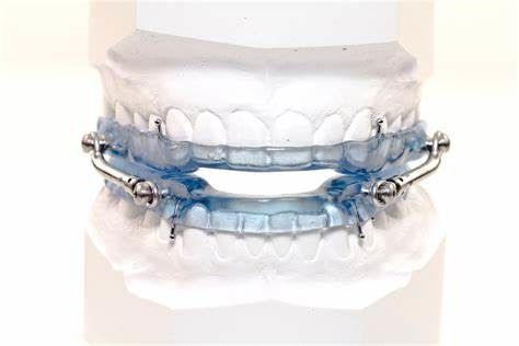การทดสอบมาตรฐานปริมาตรส่วนสําหรับอุปกรณ์อนามัยทางปาก: GB 4706.59-2008